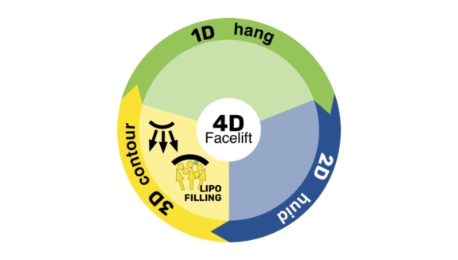3D vulling en contour | drStevens.nl