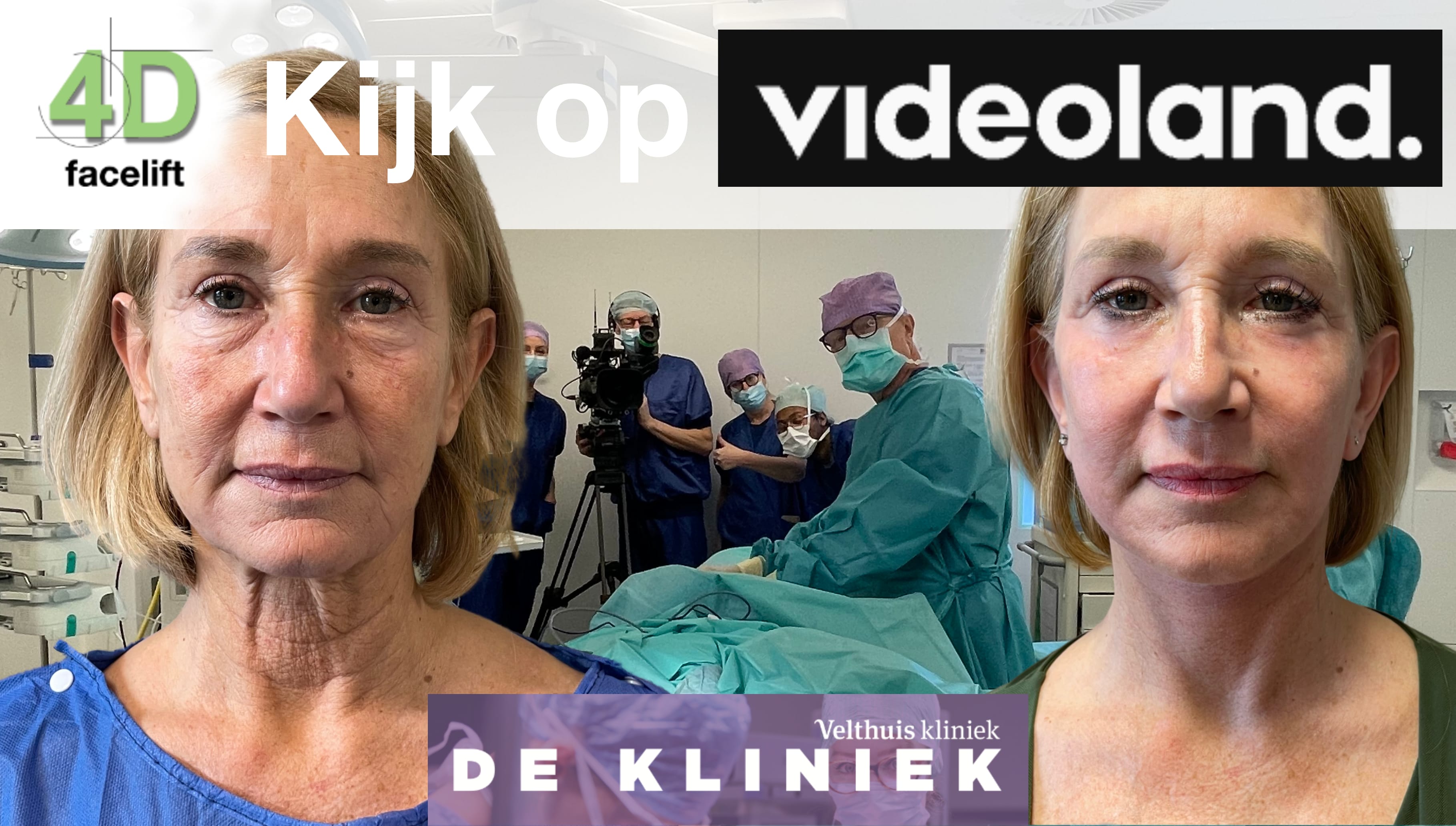 Kijk op Videoland naar de 4D-Facelift | drStevens.nl