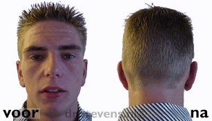 oorcorrectie aangezicht man - drstevens.nl