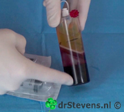 operatietechniek rode-bloedcellen bio-chirurgie aangezicht - drstevens.nl