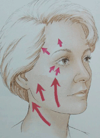 illustratie operatietechniek nieuw correctie uitstraling halslift hals-facelift aangezicht - drstevens.nl
