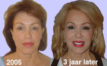 patricia-paay - drstevens.nl